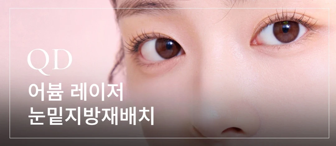 큐디의원 어븀 눈밑지방재배치 안내