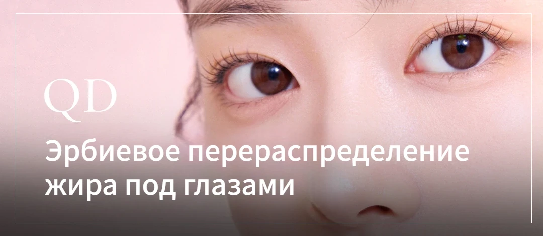 Перераспределение жира под глазами эрбиевым лазером в Корее
