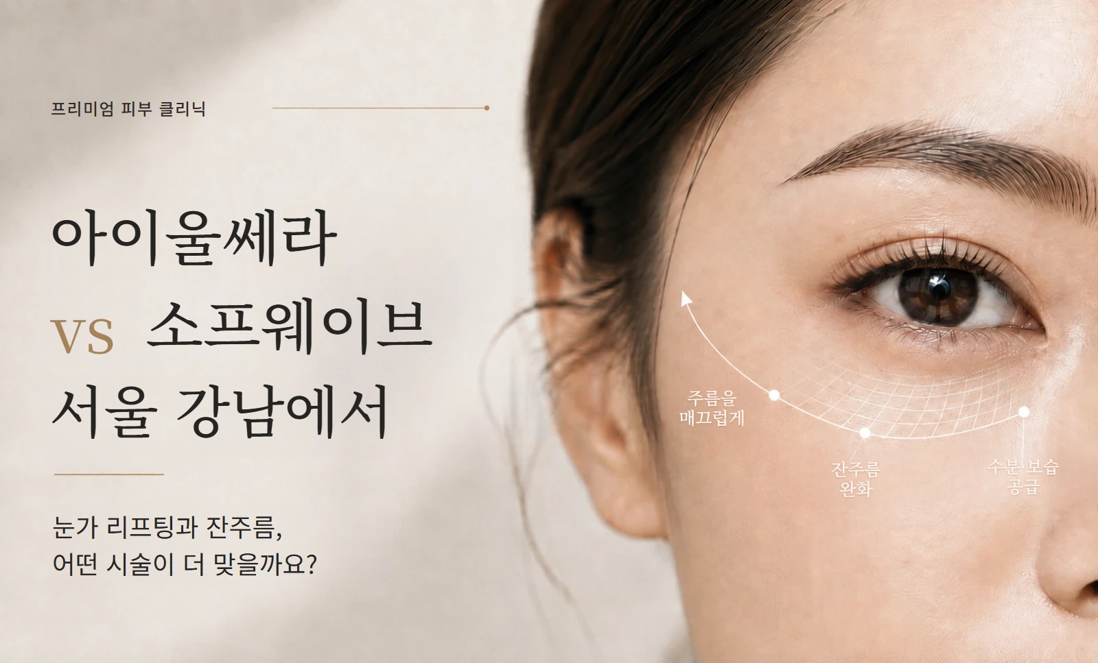 아이울쎄라와 소프웨이브 눈가 시술 비교 이미지