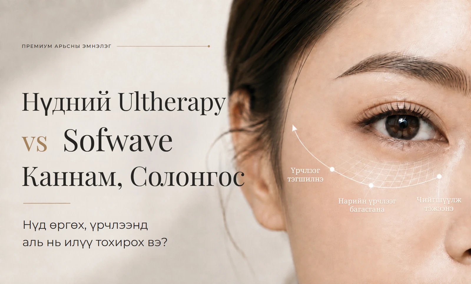 Нүдний орчмын Ultherapy ба Sofwave-ийн харьцуулалт