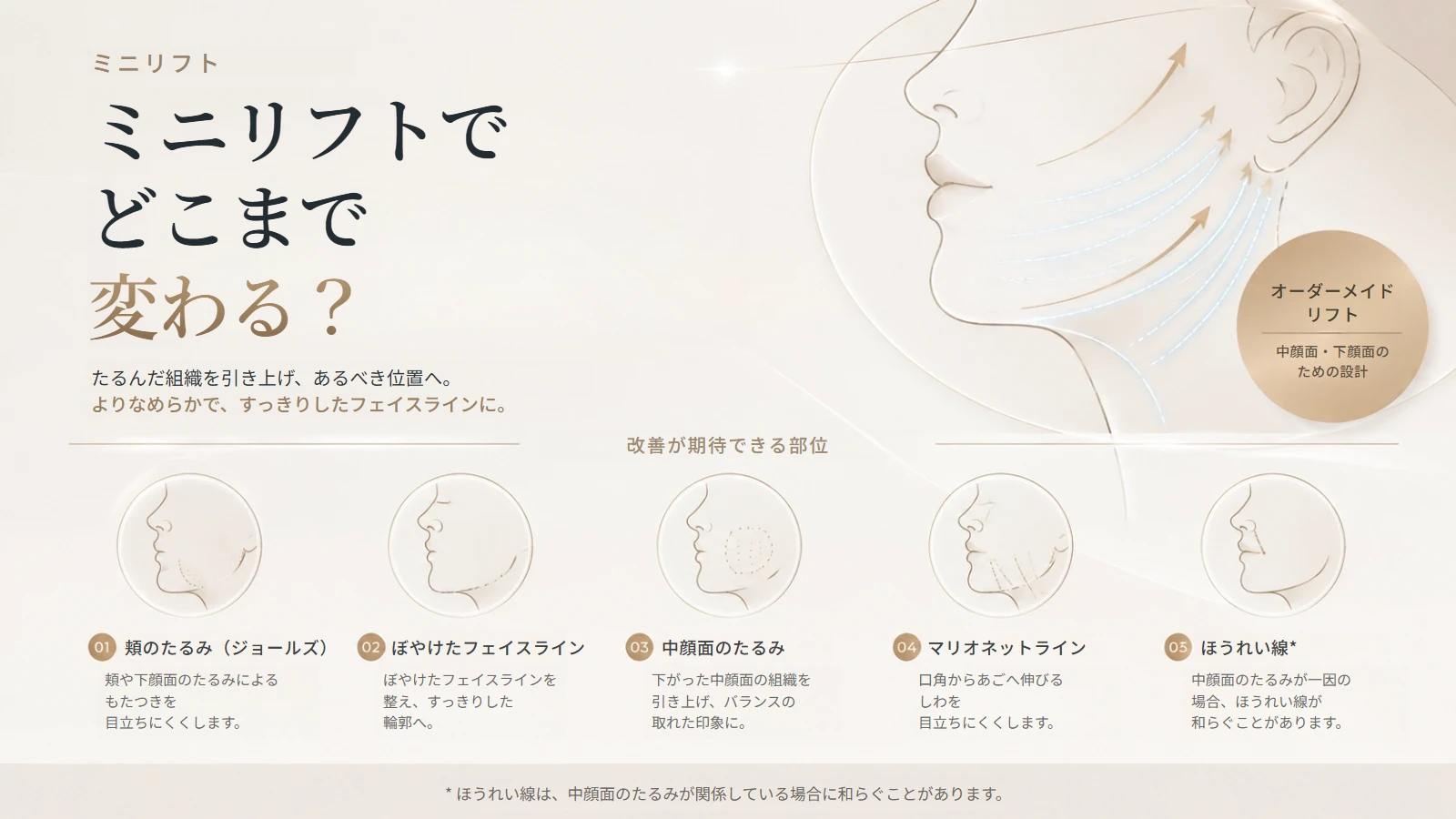 ミニリフトで改善が期待できる部位の解説イメージ