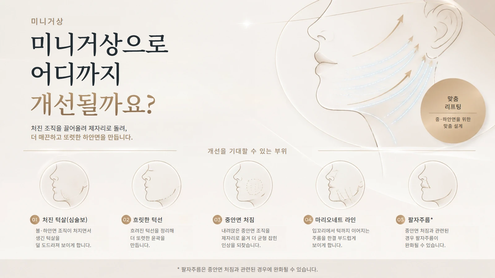 미니거상으로 개선 가능한 부위 안내 이미지
