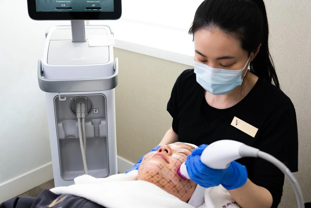 Traitement au Thermage FLX sur un visage marqué d’une grille