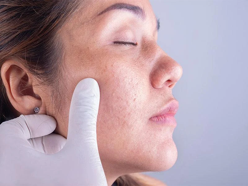 Une main gantée appuyant sur la joue pour vérifier la sensibilité au toucher