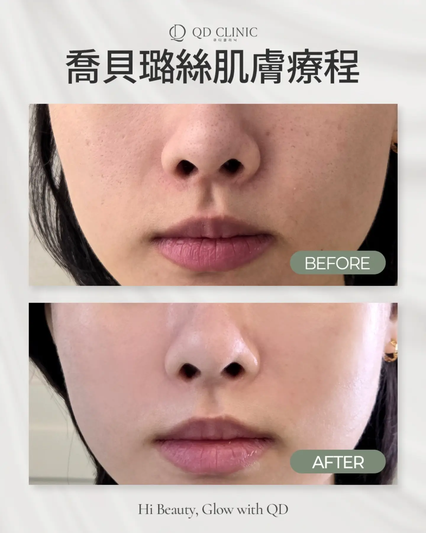 打开这条 Instagram 帖子